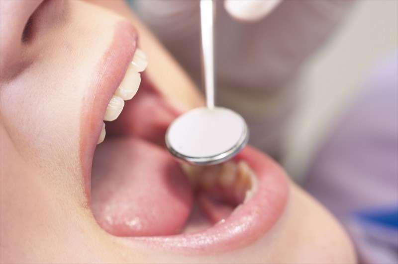 見た目や機能性にもこだわる歯医者の審美治療が大宮区で好評